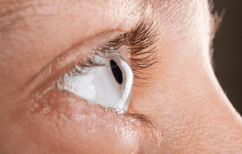 Коррекция зрения при близорукости